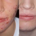 Royal Skin 500 – отзиви – мнения – форум – бг мама – коментари