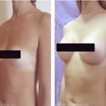Wow Bust – цена в българия – аптеки