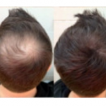 Chevelo Shampoo – аптеки – цена в българия