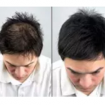 Chevelo Shampoo – състав