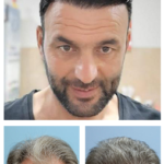 Hair Intense – аптеки – цена в българия
