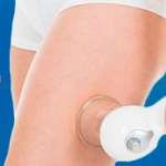 Cellulite Massage – цена в българия – аптеки