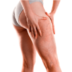 Varicol – цена в българия – аптеки