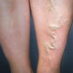 Veinaritin – коментари – отзиви – бг мама – форум – мнения