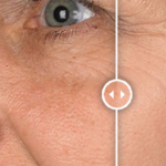 Elesse Cream – състав