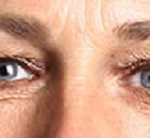 Elesse Cream – форум – отзиви – коментари – бг мама- мнения