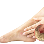 Varicone – отзиви – форум – мнения – коментари – бг мама