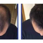 Folisin – коментари – бг мама – мнения – форум – отзиви