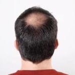 Folicerin – бг мама – мнения – форум – отзиви – коментари