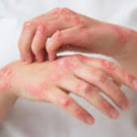 Psoryden – аптеки – цена в българия