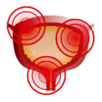 Sevinal Opti – коментари – бг мама- мнения – форум – отзиви